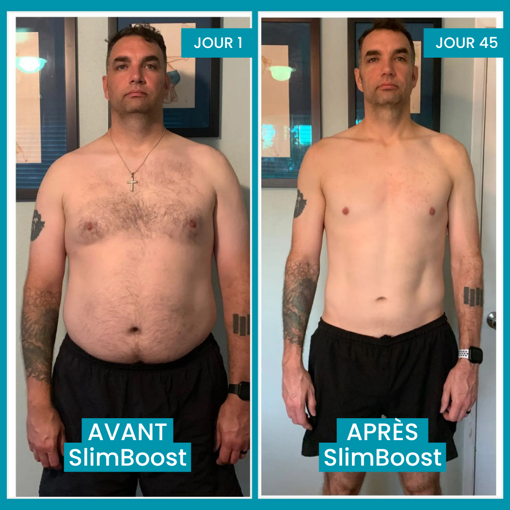 Haut Amincissant - SlimBoost™